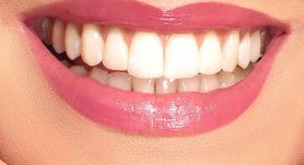 antalya esthetic dentistry